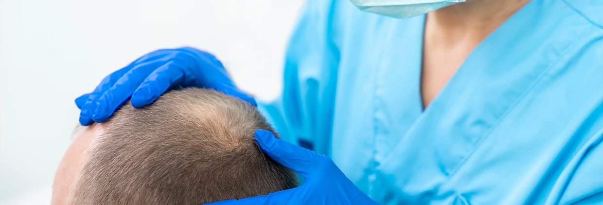 Saç Ekimi Hair Transplantation