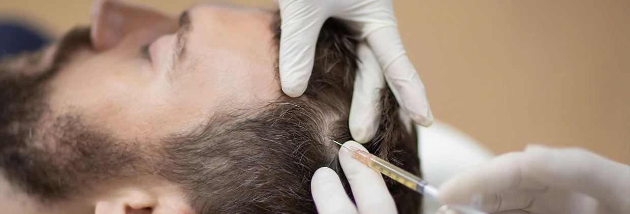 PRP ile Saç Güçlendirme Seansları: Ne Kadar Sıklıkla Yaptırmalısınız? PRP Hair Strengthening