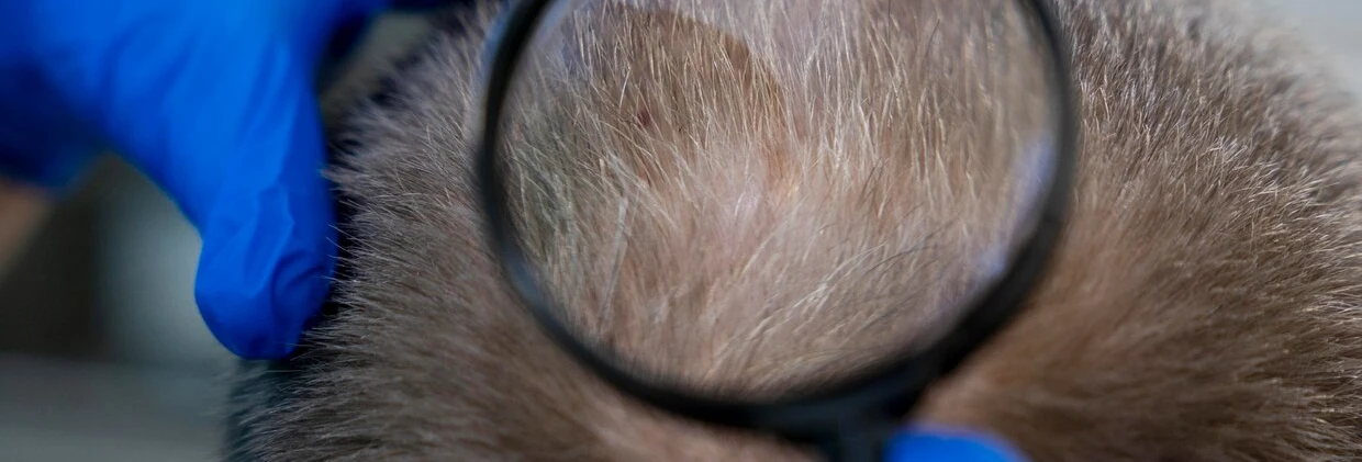 Saç Ekimi Sonrası 1. Ay