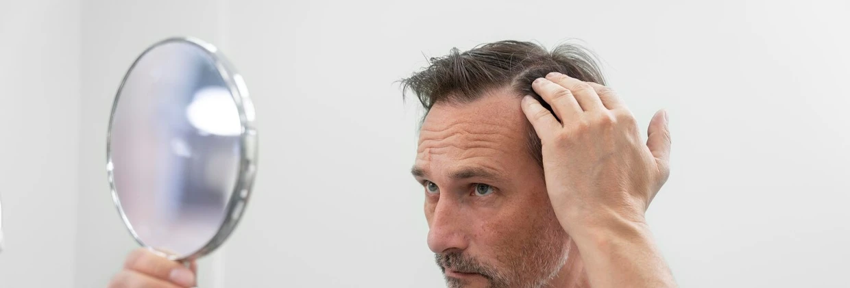 Saç Ekimi Sonrası Saçlar Ne Zaman Çıkar