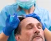 Saç Ekimi Fiyatları Nasıl Belirlenir? 2025 Kılavuzu How Are Hair Transplant Prices Determined?