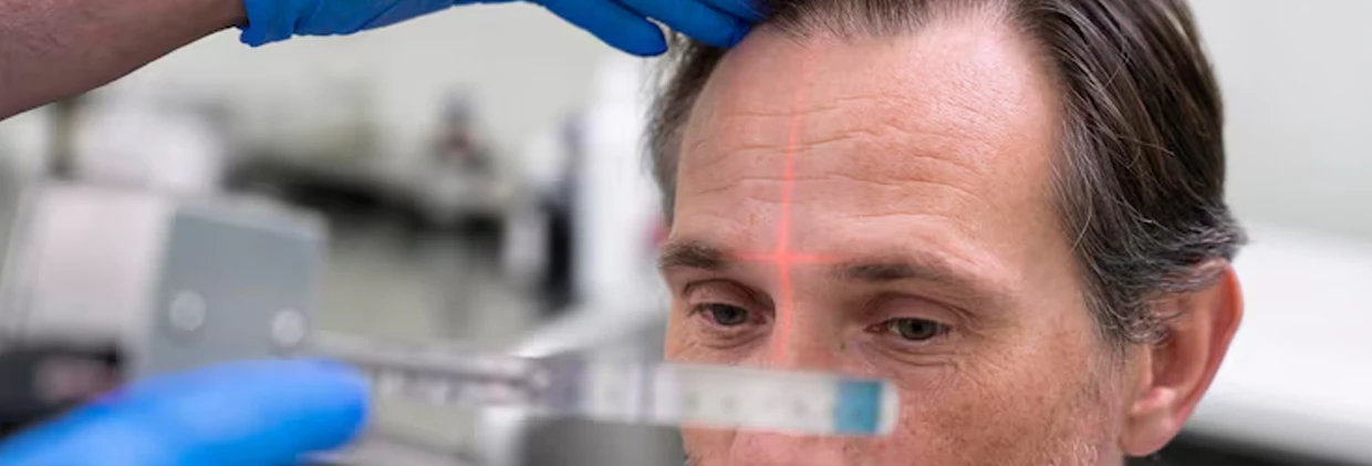 Neden DHI Saç Ekimi Sadece En Başarılı Kliniklerde Yapılmalı? Invisible Hair Transplant: Is an Unshaven Application Possible with the FUE Technique?