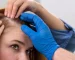 Kadın Tipi Saç Dökülmesi: Nedenler ve Tedavi Yolları Female Pattern Hair Loss: Causes and Treatment Ways
