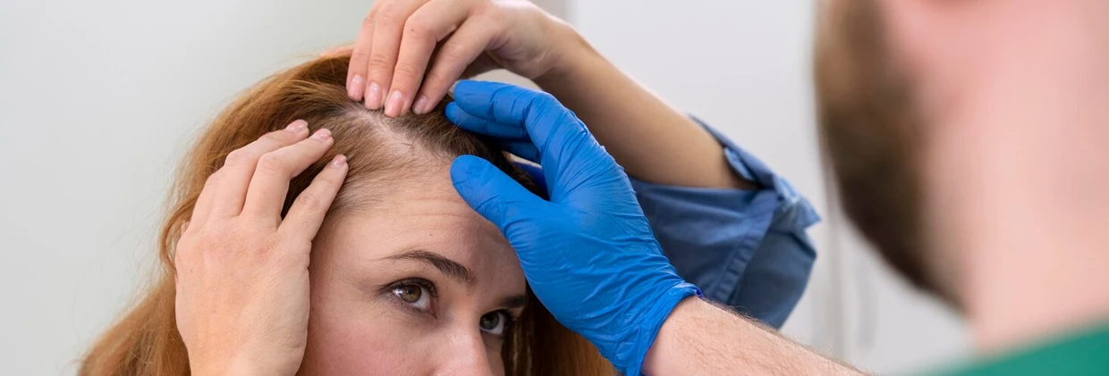 Kadın Tipi Saç Dökülmesi: Nedenler ve Tedavi Yolları Female Pattern Hair Loss: Causes and Treatment Ways